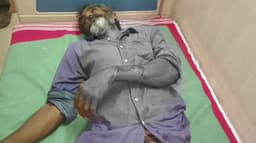 கடலூர் அருகே காட்டுப்பன்றி தாக்கி 2 விவசாயிகள் படுகாயம்