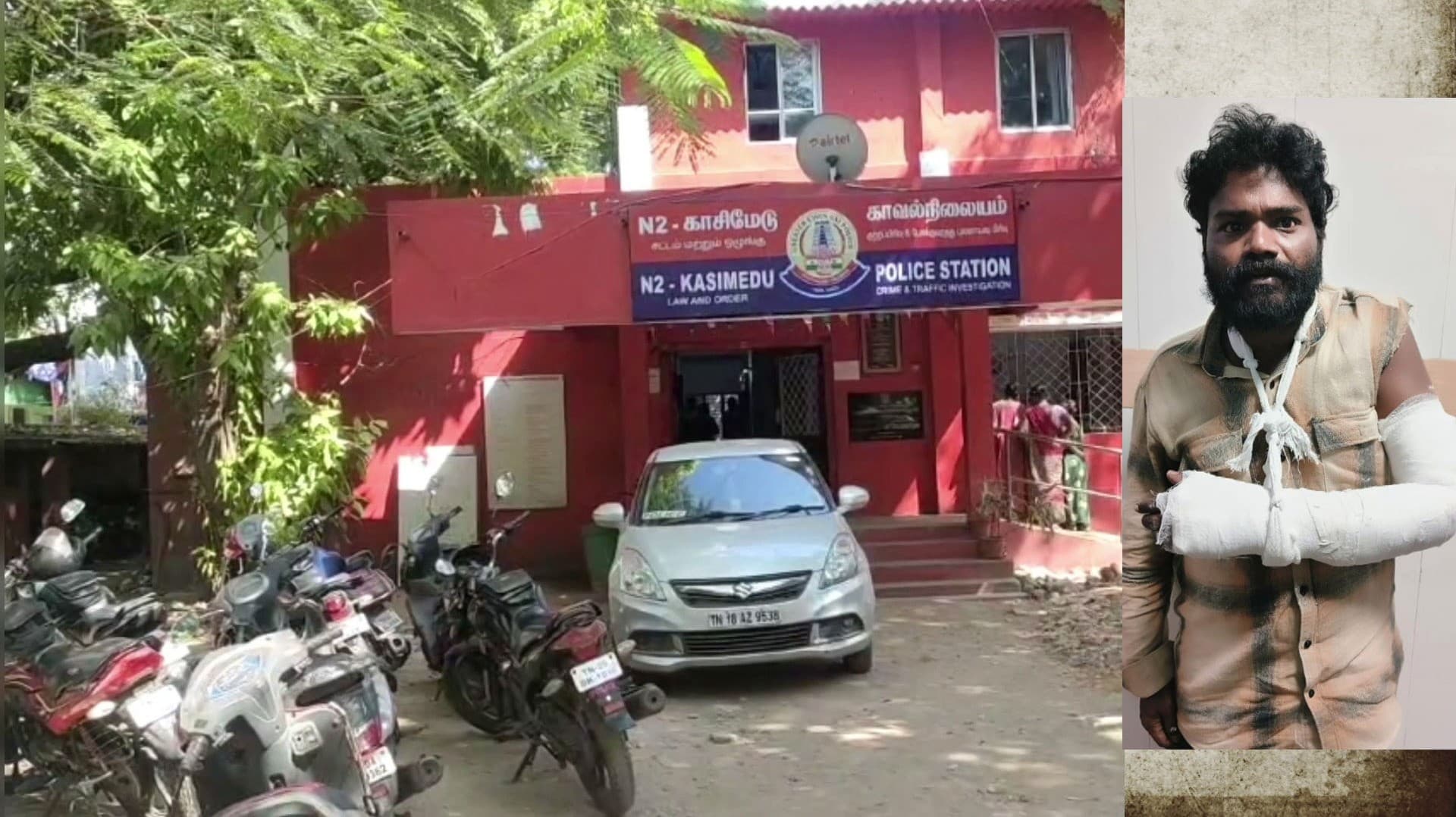 ஹோட்டல் உரிமையாளரின் மண்டையை உடைத்த ரௌடி.. தவறி விழுந்து  இடது கையில் மாவுக்கட்டு..