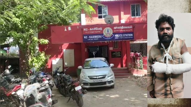 ஹோட்டல் உரிமையாளரின் மண்டையை உடைத்த ரௌடி.. தவறி விழுந்து  இடது கையில் மாவுக்கட்டு..