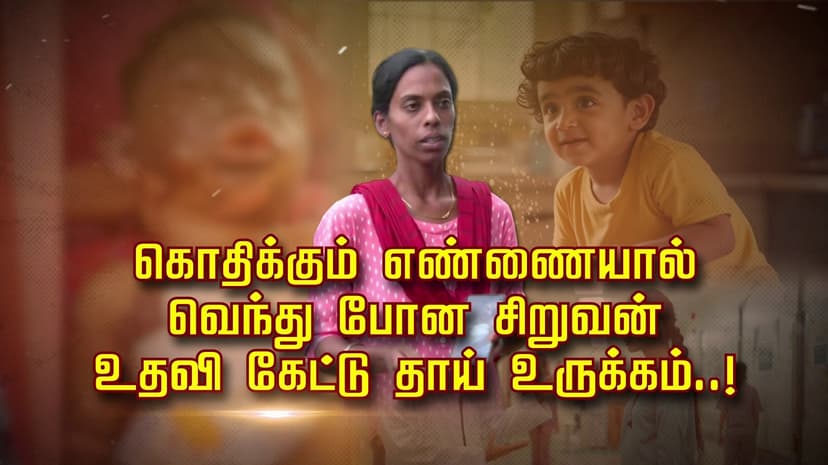 கொதிக்கும் எண்ணையால் வெந்து போன சிறுவன்.. உதவி கேட்டு தாய் உருக்கம்..!