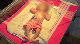 பிறந்து சில மணி நேரங்களே ஆன பெண் குழந்தையை  முட்புதரில் வீசி சென்ற கொடூரம்