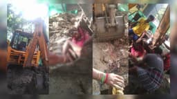 குடிநீர் வாரிய பணியின்போது வலிப்பு வந்ததால் துண்டான கால்