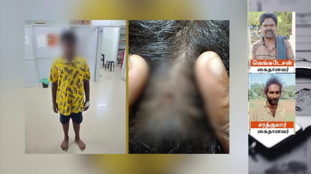 உடல் நலன் பாதிக்கப்பட்ட தெருநாயை துப்பாக்கியால் சுட முயற்சி - பள்ளி மாணவன் தலையில் ஈயகுண்டு பாய்ந்தது..