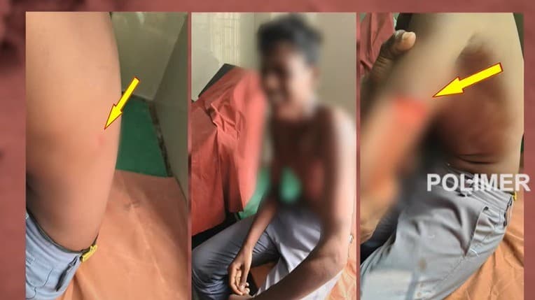 பள்ளியில் கபடி விளையாடிய போது தகராறு - மாணவனை கத்தியால் கீறி தாக்குதல்