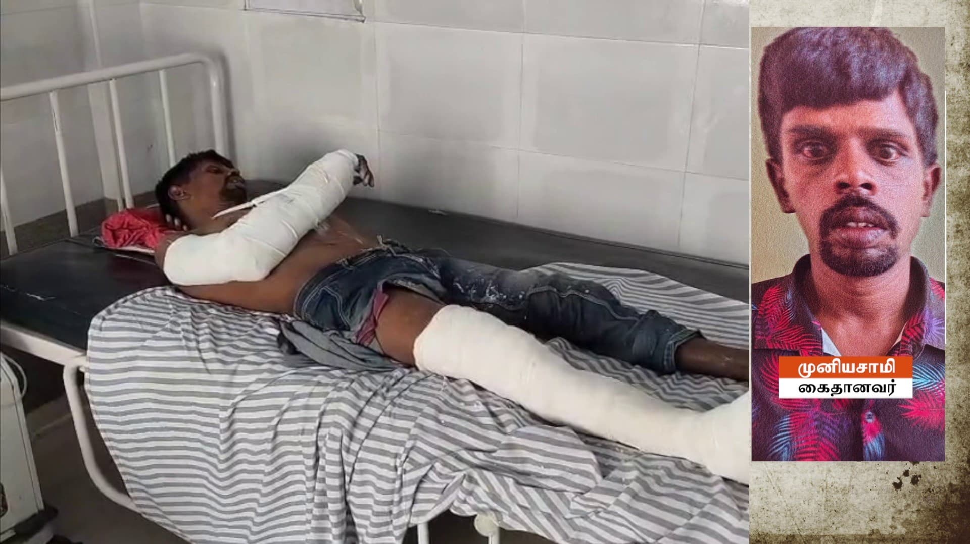 கோவில் காவலாளிகள் 2 பேர் கொலை- கைதானவருக்கு மாவுக்கட்டு