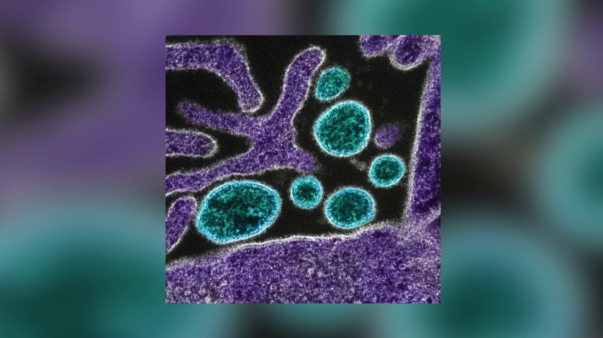 நிபா வைரஸ் தொற்று காரணமாக, இந்தியாவுக்கு பயணம் மற்றம் வர்த்தகத் தடைகள் விதிக்க வேண்டிய தேவை இல்லை - WHO