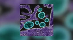 நிபா வைரஸ் தொற்று காரணமாக, இந்தியாவுக்கு பயணம் மற்றம் வர்த்தகத் தடைகள் விதிக்க வேண்டிய தேவை இல்லை - WHO