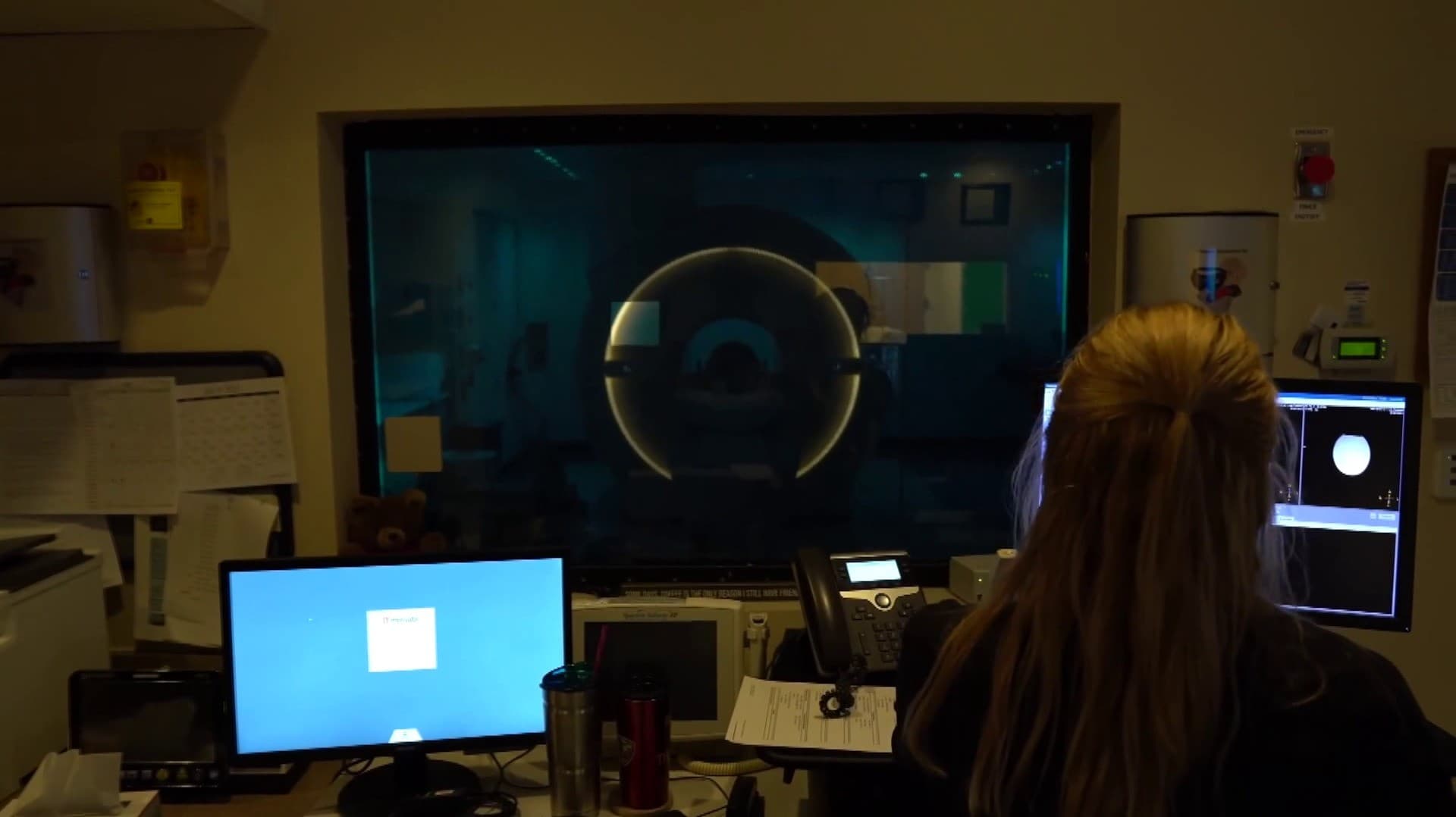 மூளையின் MRI ஸ்கேனை ஆராய்ந்து, நோய்களை கண்டறியும் ஏ.ஐ. மாடலை உருவாக்கிய அமெரிக்க ஆராய்ச்சியாளர்கள்