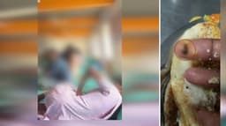 நர்சிங் கல்லூரி விடுதி உணவில் புழு, பூச்சி.. மாணவிகள் குற்றச்சாட்டை மறுத்த கல்லூரி நிர்வாகம்.