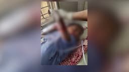 வெறி நாய் கடித்துக் குதறியதில் 7 வயது சிறுவன் படுகாயம்