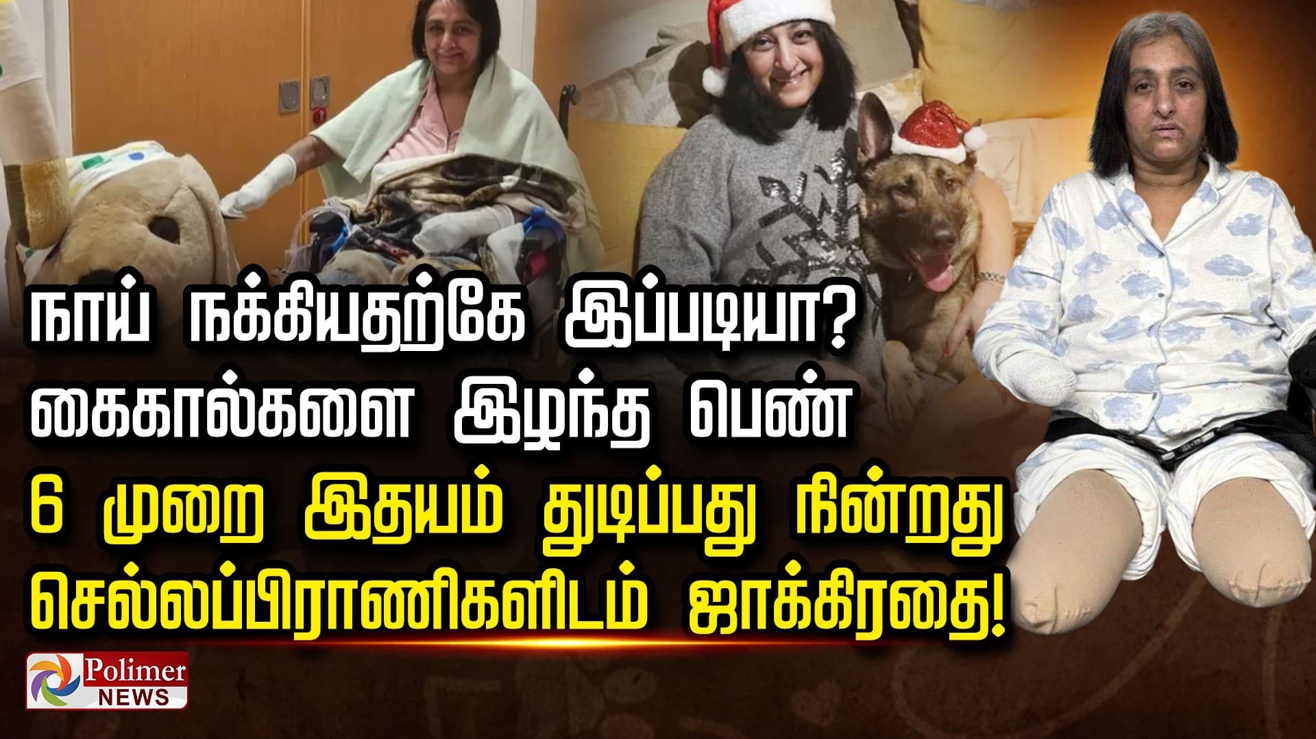 நாய் நக்கியதற்கே இப்படியா? கை-கால்களை இழந்த பெண்.. 6 முறை இதயம் துடிப்பது நின்றது... செல்லப்பிராணிகளிடம் ஜாக்கிரதை!