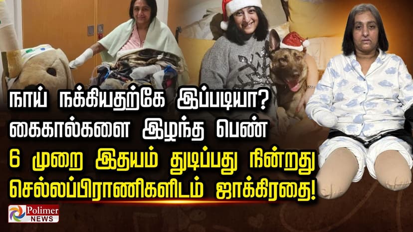 நாய் நக்கியதற்கே இப்படியா? கை-கால்களை இழந்த பெண்.. 6 முறை இதயம் துடிப்பது நின்றது... செல்லப்பிராணிகளிடம் ஜாக்கிரதை!